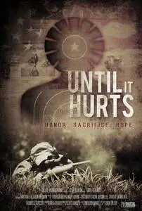 Until It Hurts (2014) posters and prints