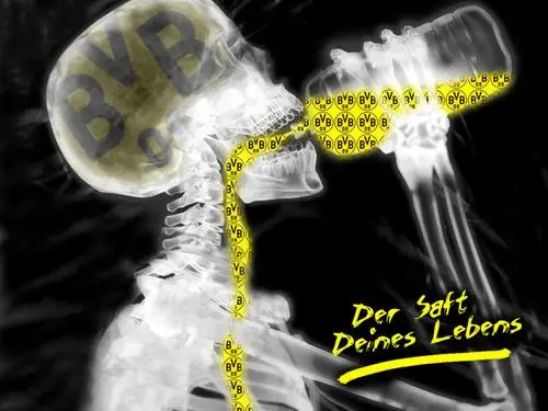 Borussia Dortmund Baseball Cap - idPoster.com